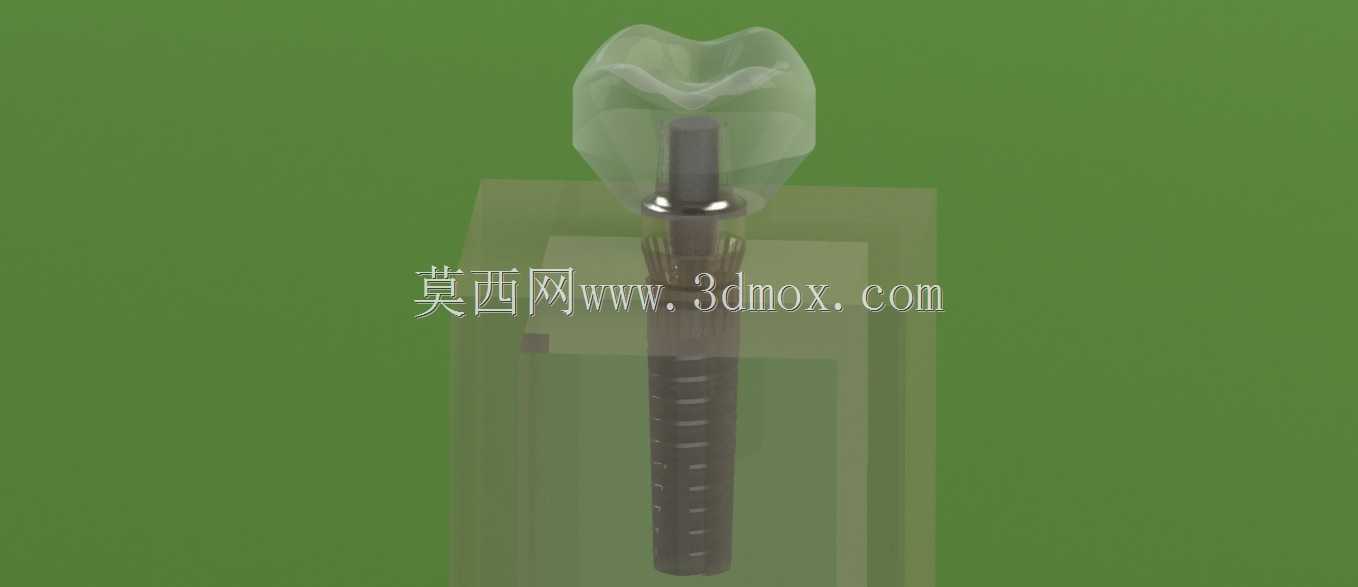 牙种植体设计与有限元分析