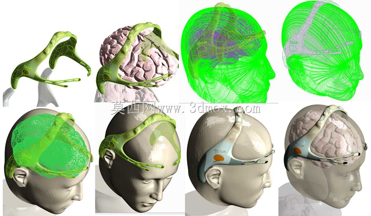 MindSonic��˾